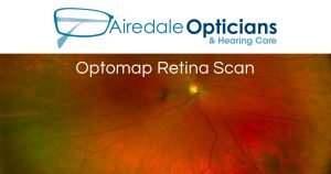 Optomap