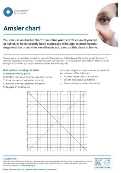 Amsler Chart